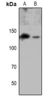 Polyclonal Rabbit anti-Human EPHA8 / EPH Receptor A8 Antibody (WB)