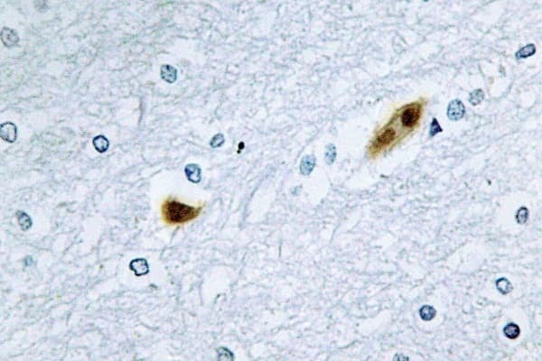 E2F2 Antibody (Lys236)
