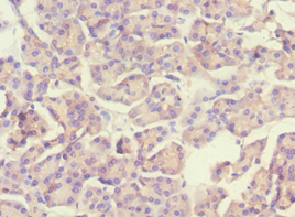 Polyclonal Rabbit anti-Human SCAD / ACADS Antibody (aa1-260, IHC, WB)
