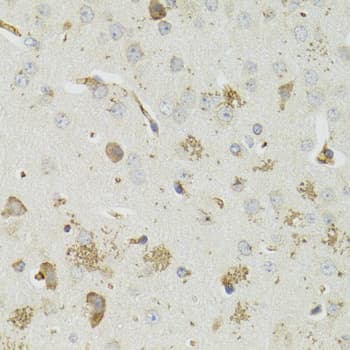 PTPN3 Antibody