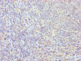 Polyclonal Rabbit anti-Human PPIB / Cyclophilin B Antibody (aa34-216, IHC, WB)