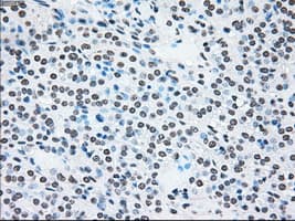 BRAF / B-Raf Antibody (clone OTI4C5)