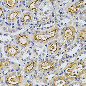ADRBK1 / GRK2 Antibody