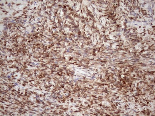 TCEAL1 Antibody (clone OTI2G10)