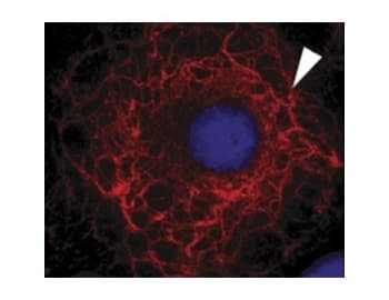 KRT3 / CK3 / Cytokeratin 3 Antibody (clone AE5)
