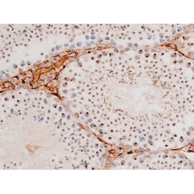 FOXO4 / AFX1 Antibody (phospho-Ser197)