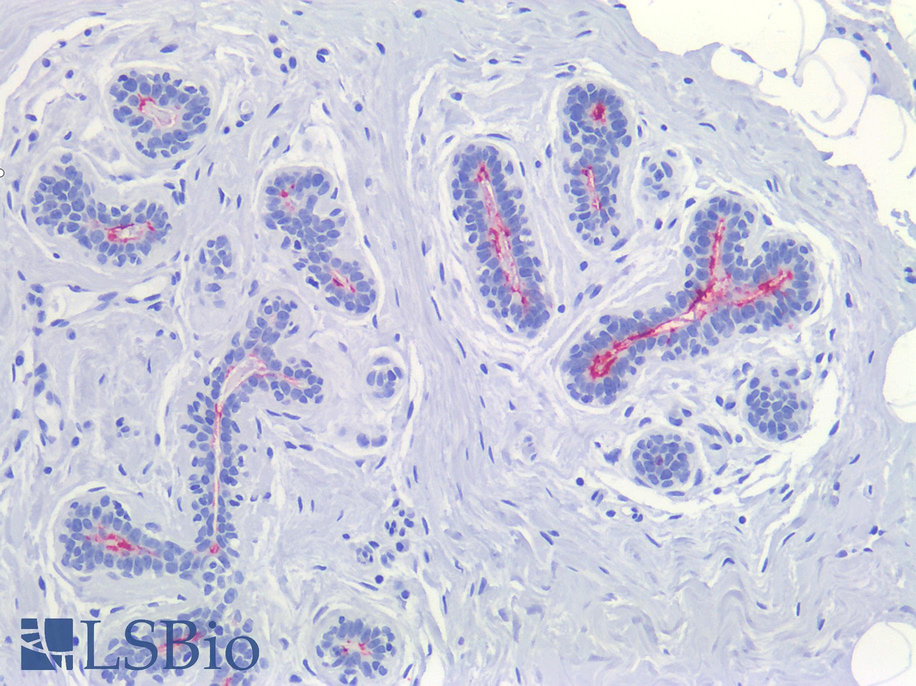 PathPlus™ Monoclonal Mouse anti-Human Sialylated Lewis a / CA 19-9 Antibody (IHC)