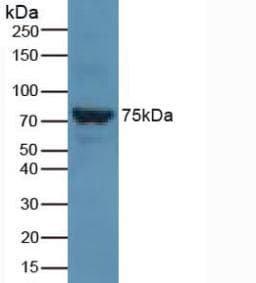 SLC27A5 / BACS Antibody (aa488-690)