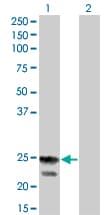 RGS4 Antibody (clone 2B2)
