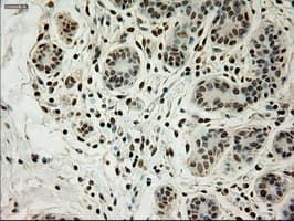 Monoclonal Mouse anti-Human L1CAM Antibody (clone OTI10C12, IHC, WB)
