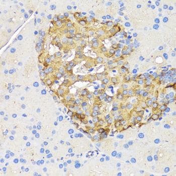 Insulin Antibody