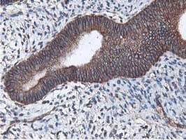 Latexin / MUM Antibody (clone OTI1E10)