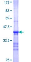 Human STRN3 Protein (Recombinant GST, N-terminus)