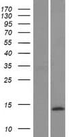 Human CALCB Protein (Over-Expression Lysate Myc-DDK (Flag))