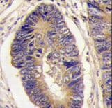 PTPN3 Antibody (aa366-397)