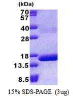 Human HBQ1 Protein (Recombinant His)