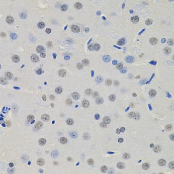 Polyclonal Rabbit anti-Human BSAC / MKL1 Antibody (IHC, WB)