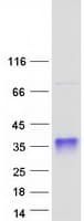Human SSU72 Protein (Recombinant Myc-DDK (Flag))