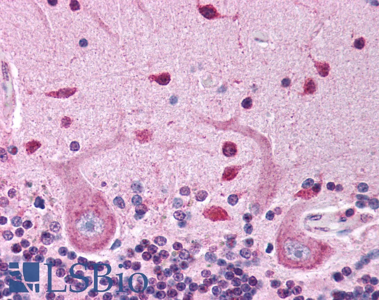 PDK1 Antibody (Internal, DY488)