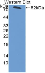 CDH1 / E Cadherin Antibody (aa155-882, Biotin)