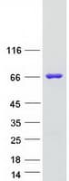 Human FTO Protein (Recombinant Myc-DDK (Flag))