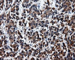 SRR / Serine Racemase Antibody (clone OTI1D7)