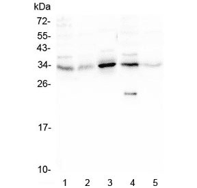 Polyclonal Rabbit anti-Human PPA1 Antibody (IHC, WB)