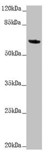 KRT6A / CK6A / Cytokeratin 6A Antibody