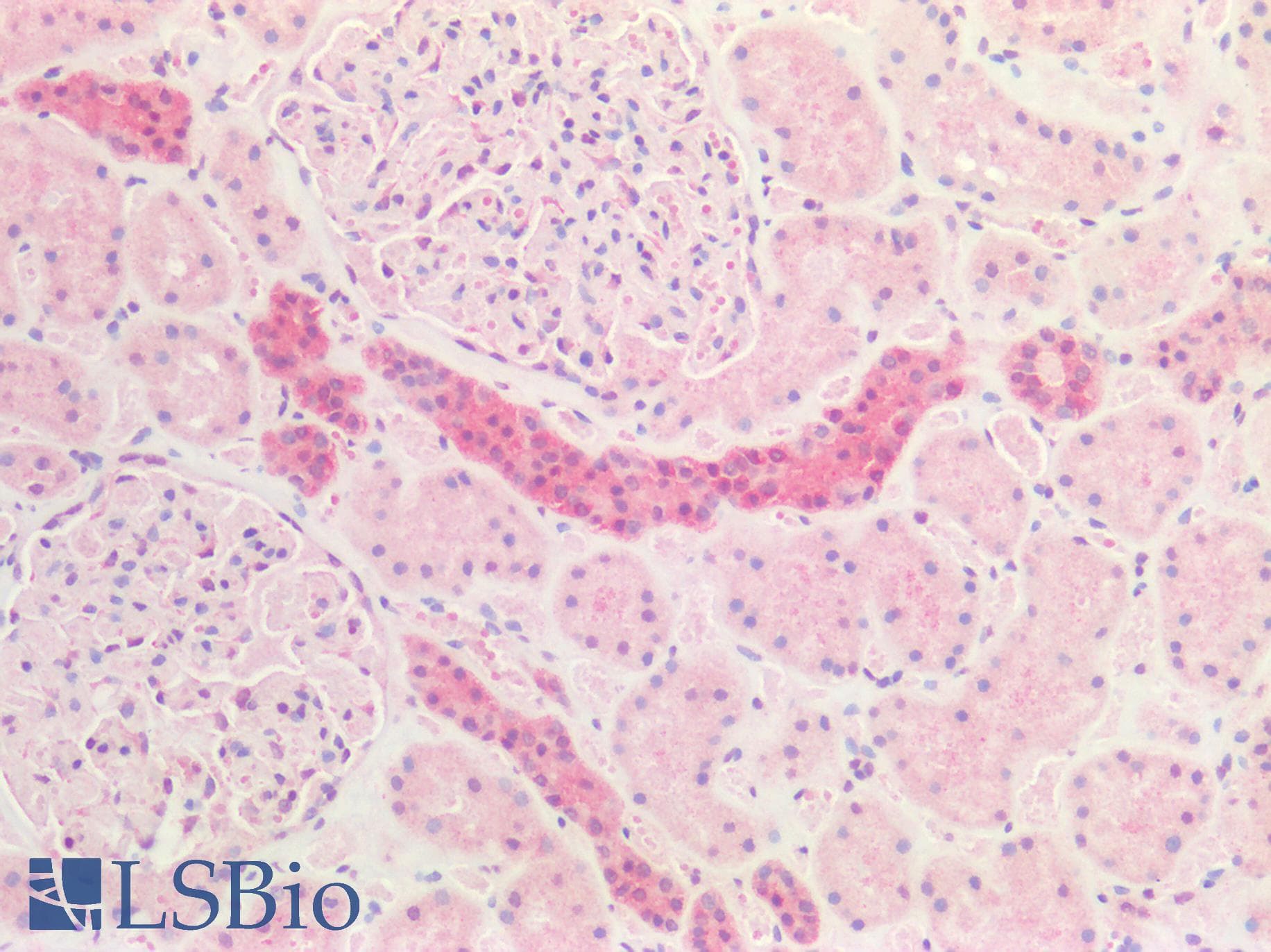 IHC-plus™ Polyclonal Rabbit anti-Human CX3CL1 / Fractalkine Antibody (IHC)