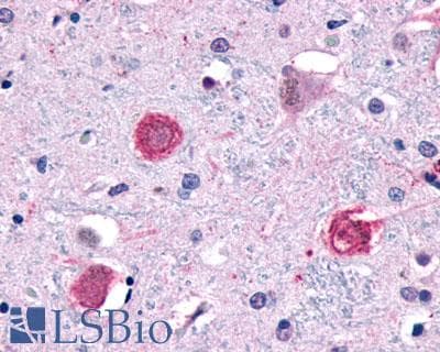PathPlus™ Polyclonal Rabbit anti-Human GPR1 Antibody (C-Terminus, IHC)