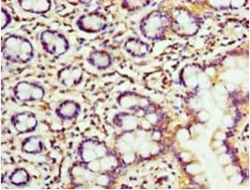 FKBP25 / FKBP3 Antibody (aa2-224)