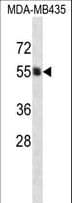 GPI3 / PIGA Antibody (aa455-484)