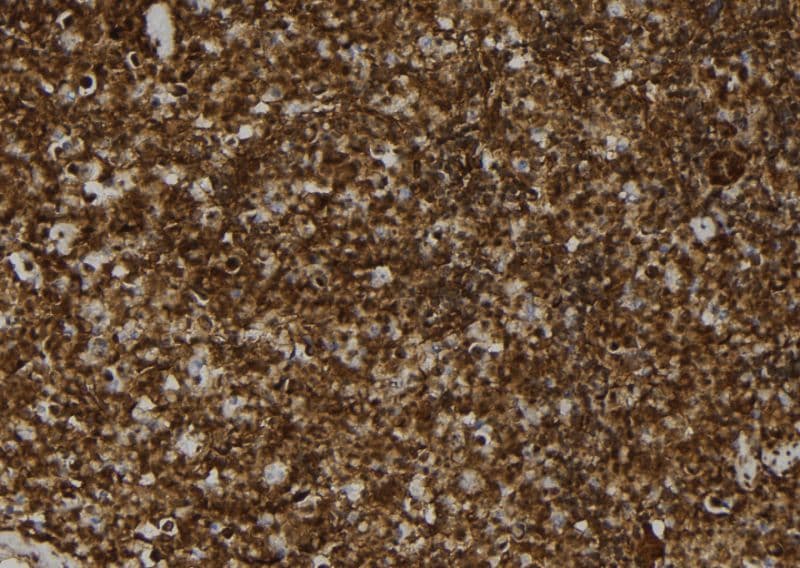 MAT2B Antibody