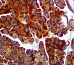 PDGFRB / PDGFR Beta Antibody (clone RBT-PDGFRB, Ready-to-Use)