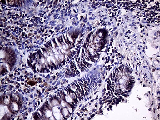 Monoclonal Mouse anti-Human HABP2 Antibody (clone OTI5H3, aa33-330, IHC, WB)