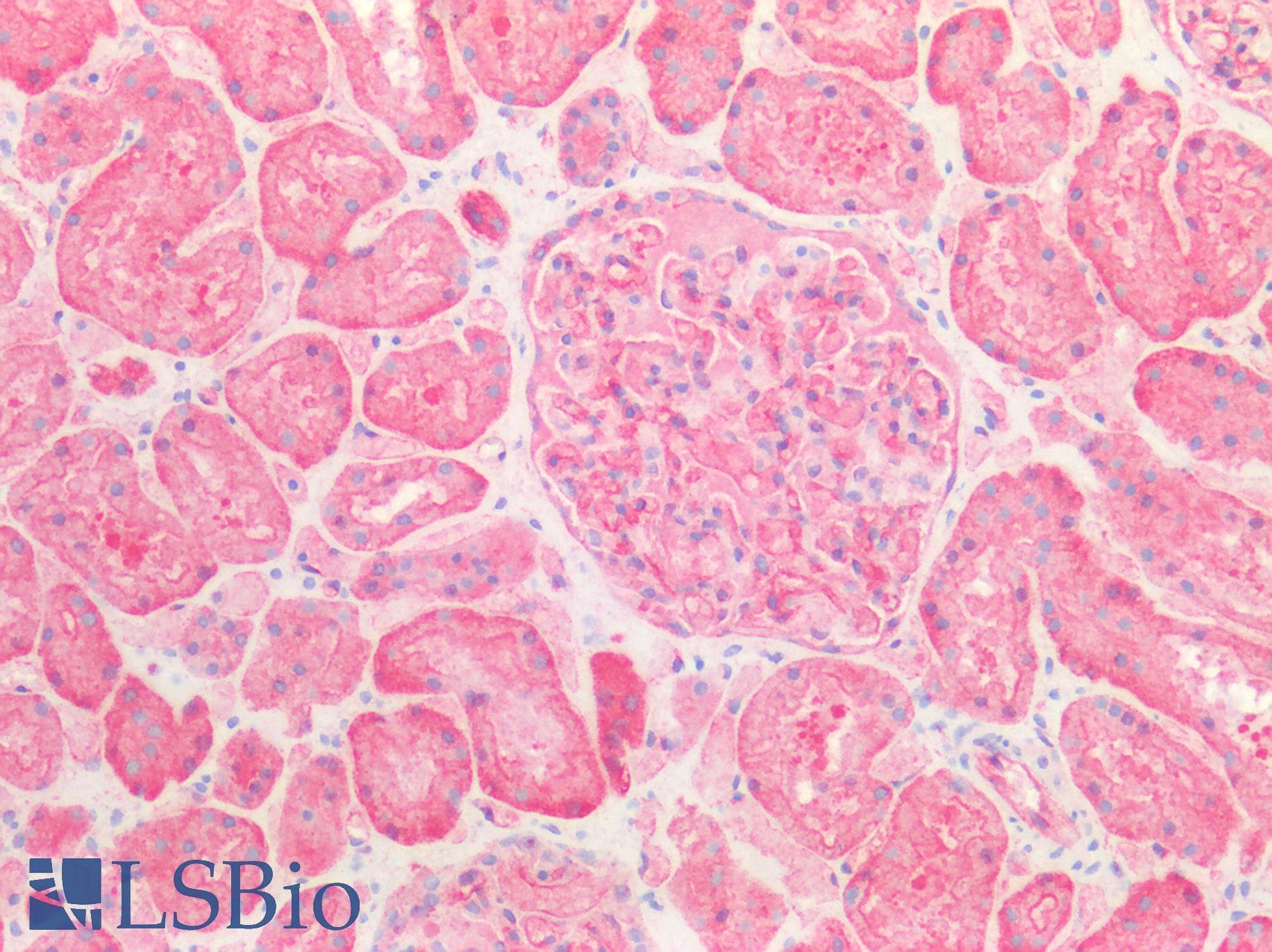 IHC-plus™ SPTAN1 / Alpha Fodrin Antibody