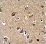 TTC9B Antibody (aa177-206)