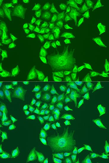 IHC-plus™ APOA1 / Apolipoprotein A 1 Antibody