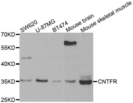 IHC-plus™ Polyclonal Rabbit anti-Human CNTFR Antibody (IHC, WB)