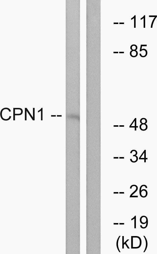 Polyclonal Rabbit anti-Human CPN1 Antibody (WB)