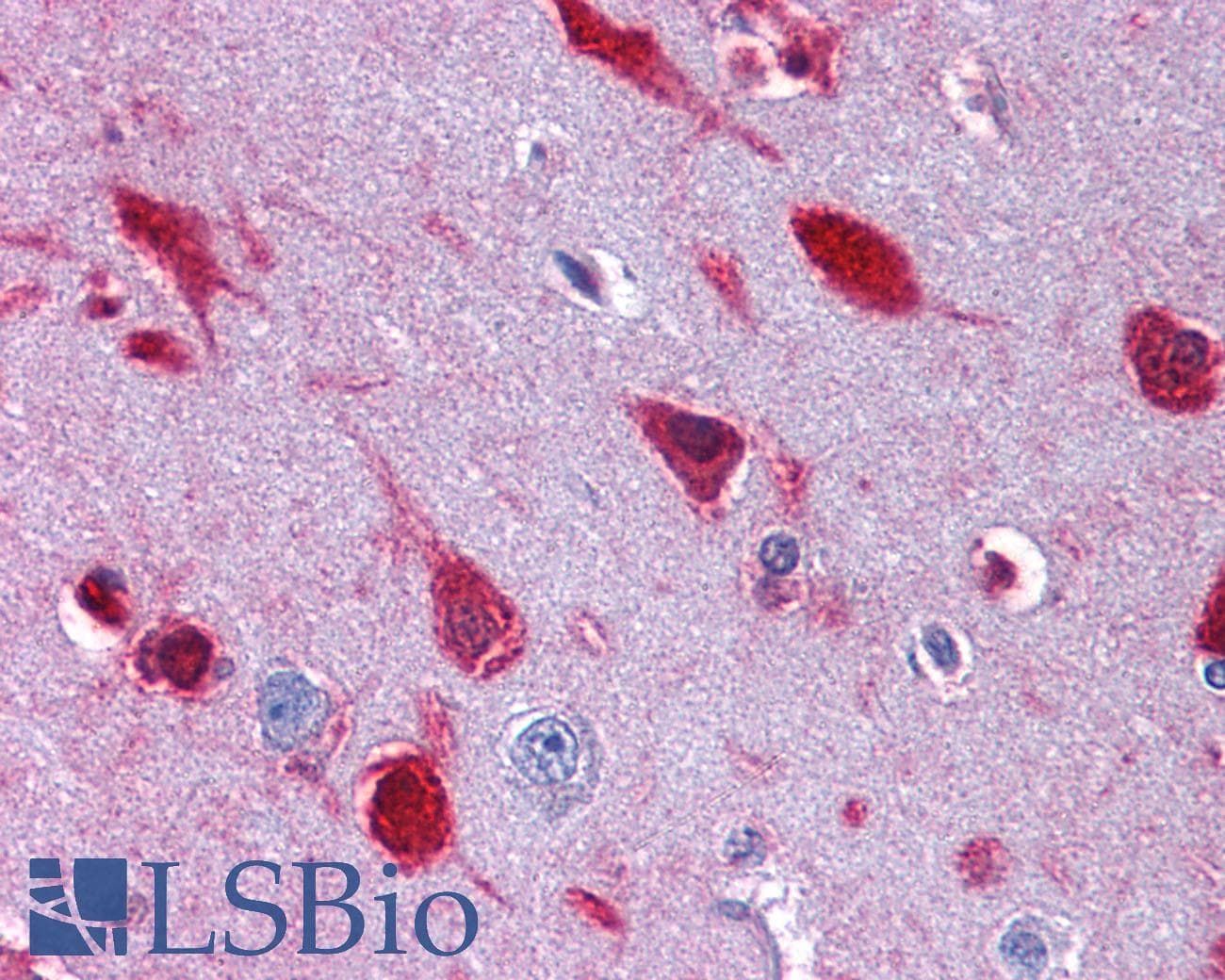 IHC-plus™ Polyclonal Goat anti-Human MRNP41 / RAE1 Antibody (aa357-368, IHC, WB)