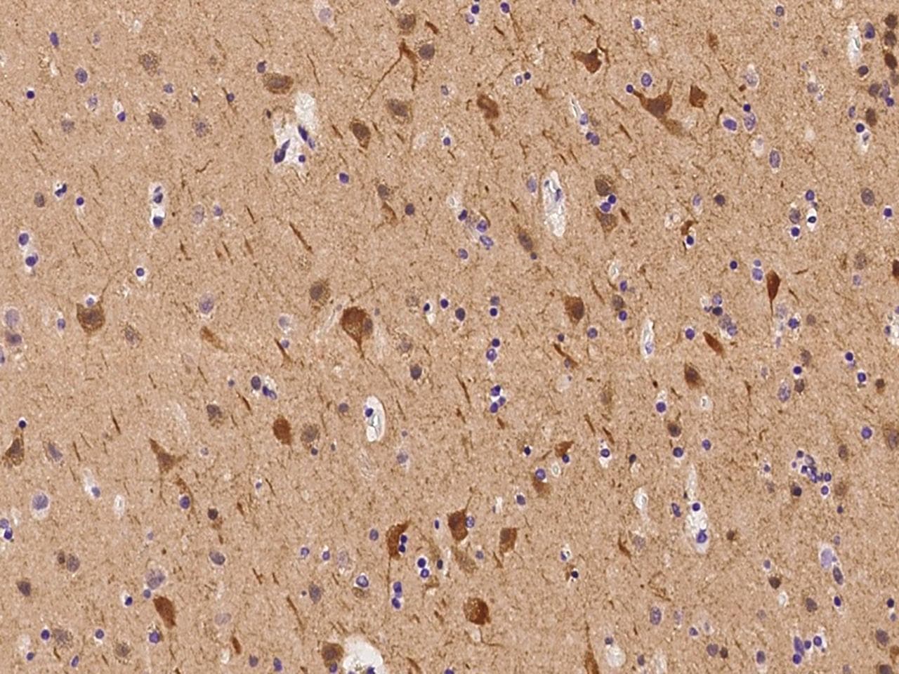 APOL2 / Apolipoprotein L 2 Antibody