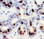 PR / Progesterone Receptor Antibody
