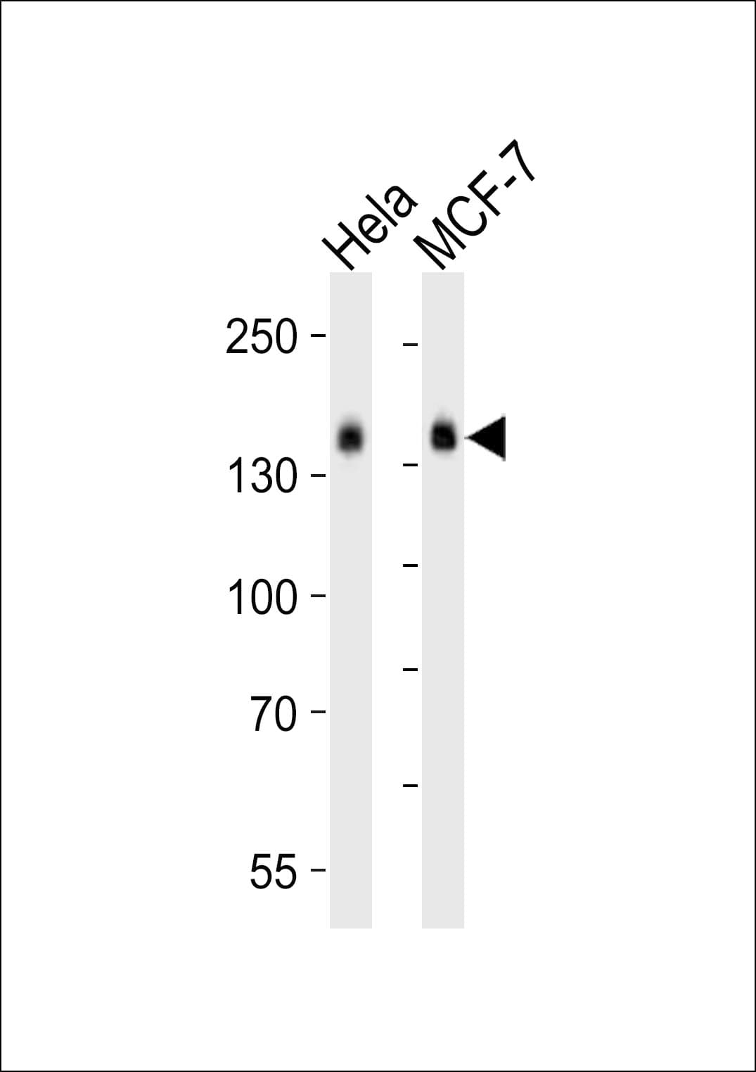 STAG2 Antibody (aa61-94)