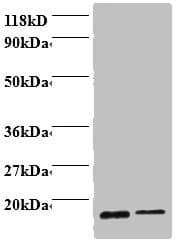 PFN1 / Profilin 1 Antibody