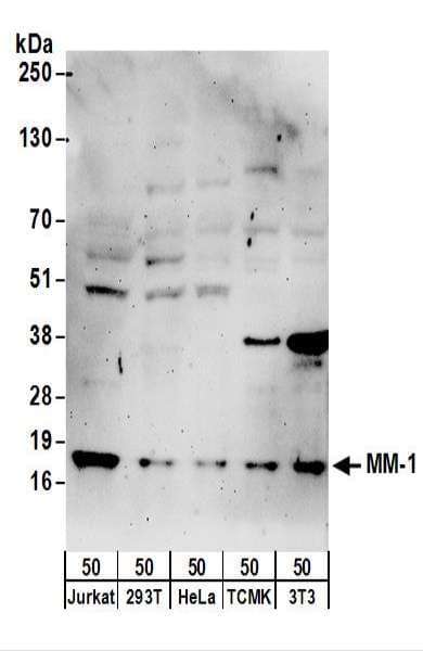 PFDN5 / MM1 Antibody (aa1-50)