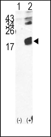 B2M / Beta 2 Microglobulin Antibody (aa8-39)