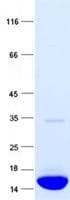 Human TTR / Transthyretin Protein (Recombinant)