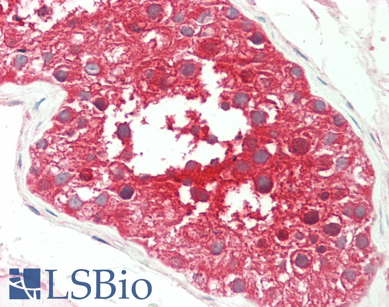 IHC-plus™ SPAG9 Antibody (aa1-50)