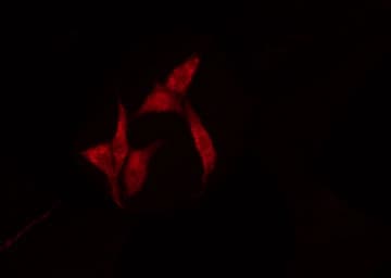 Polyclonal Rabbit anti-Human RPL10 / Ribosomal Protein L10 Antibody (IF, WB)